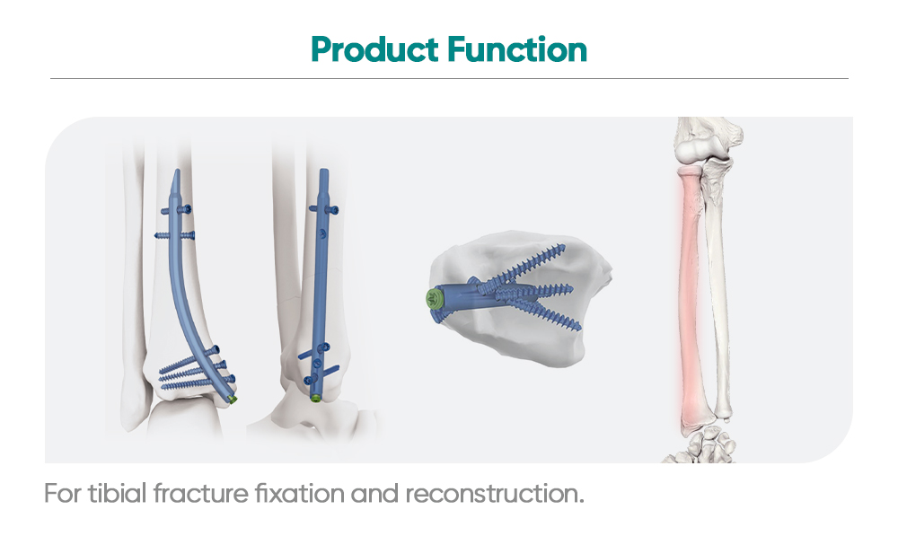 Distal Tibial Nail | Retrograde Intramedullary Fixation System | XC Medico Orthopedics