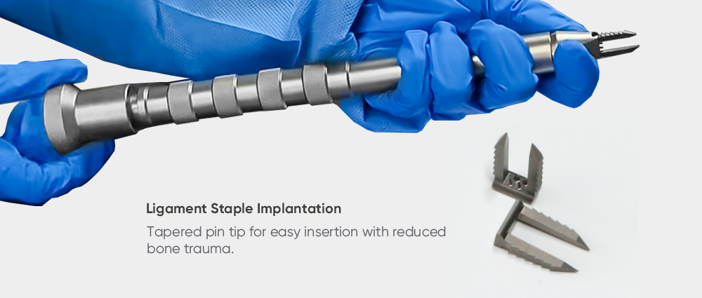 Ligament Staple | Soft Tissue Fixation for ACL Reconstruction | XC Medico Sports Medicine