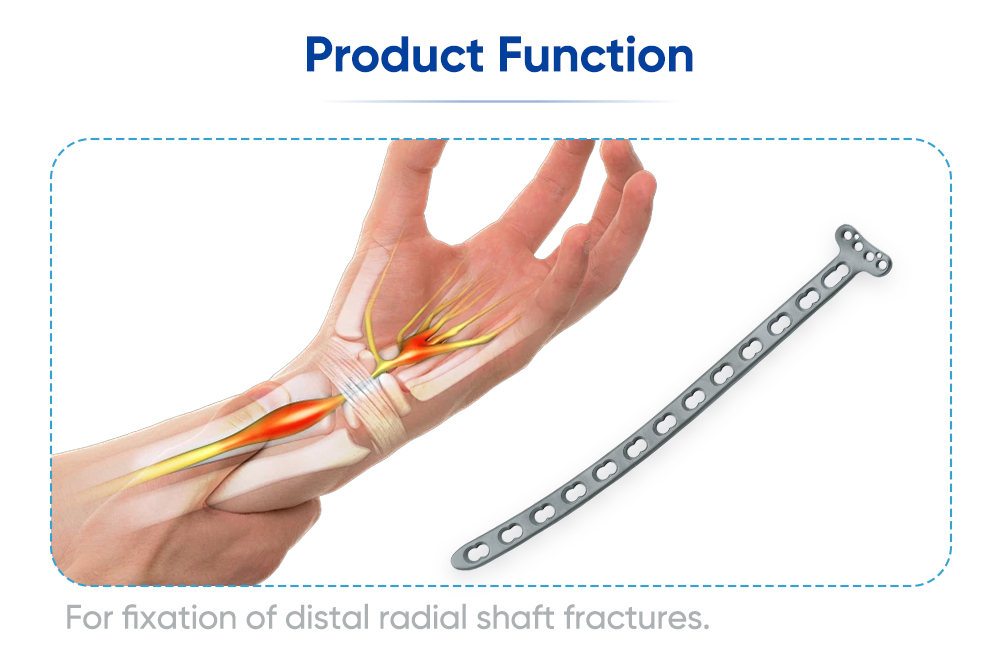 Dorsal Locking Plate for Distal Radius - Buy Product on XC Medico