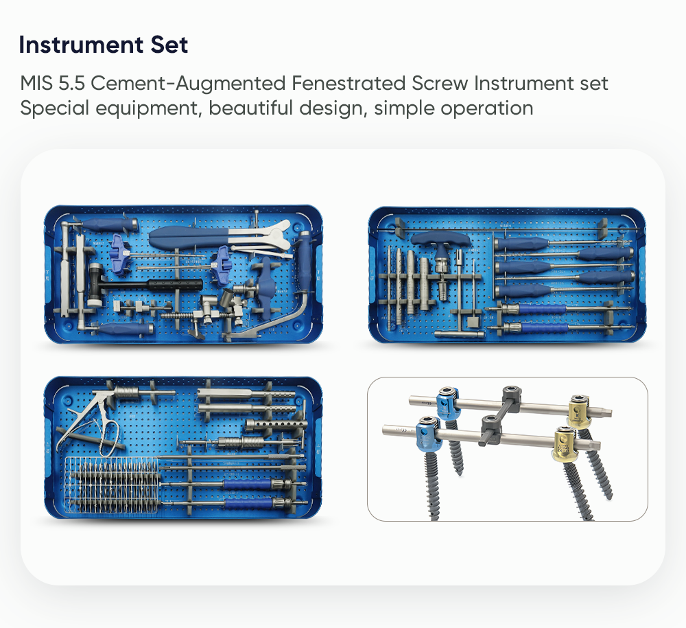 MIS 5.5 cement-augmented fenestrated screw