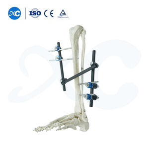  External Fixator for Leg - Buy Product on XC Medico