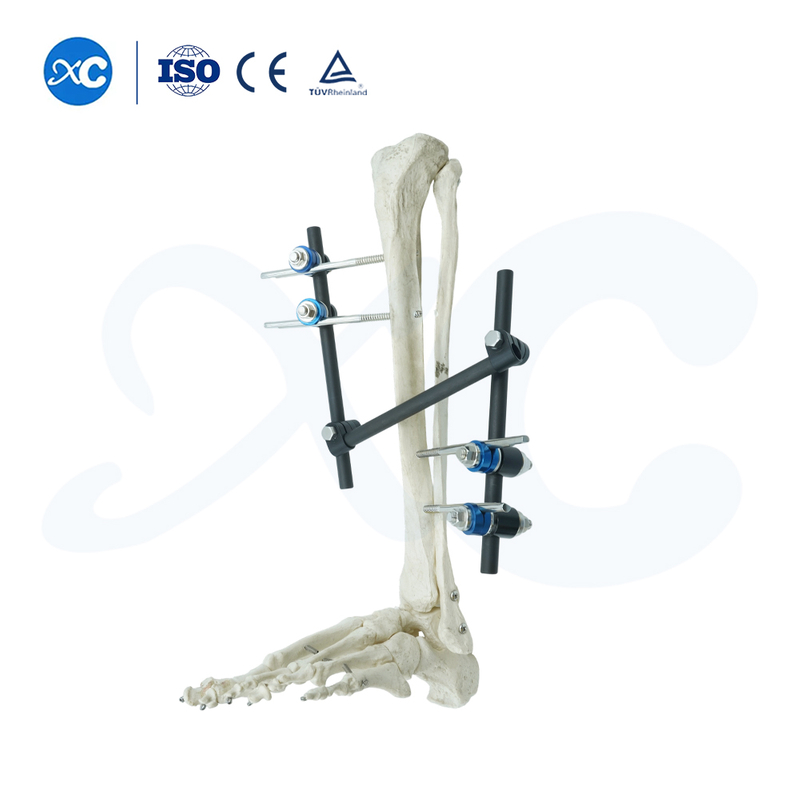  External Fixator for Leg - Buy Product on XC Medico