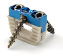 0 Profile cervical cage-II