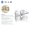 Kyphoplasty System (PKP) | Vertebral Balloon & Cement Kit