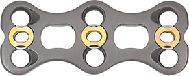 Anterior Cervical Plate-II-1