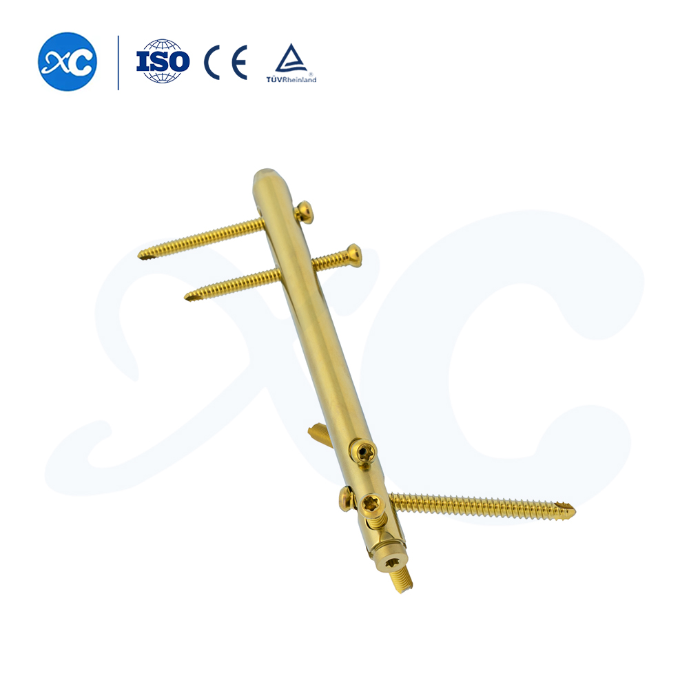 Hindfoot Fusion Ankle Nail - Buy Product on XC Medico