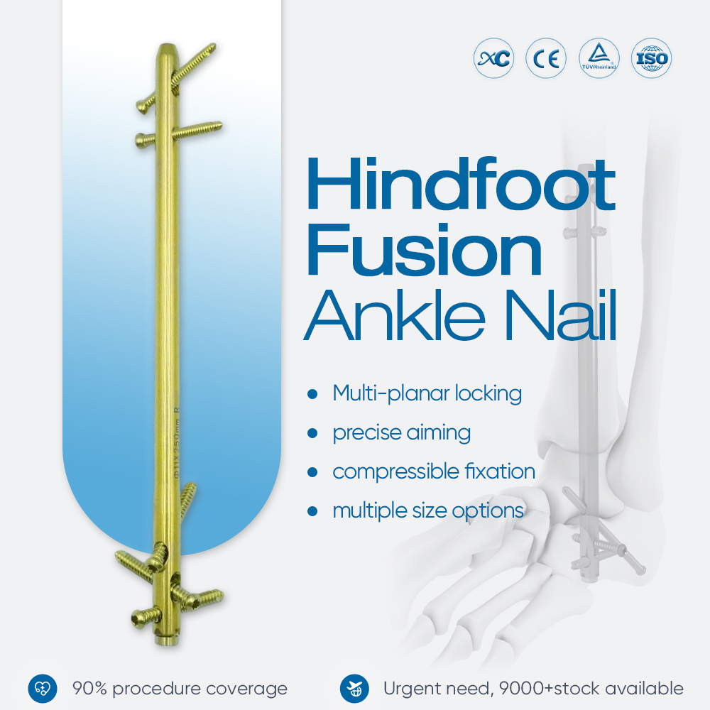Hindfoot Fusion Ankle Nail - Buy Product on XC Medico