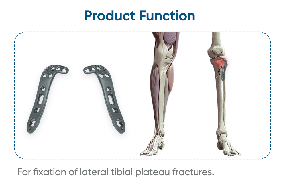 Lateral Polyaxial Locking Plate for Tibial Plateau - Buy Product on XC Medico