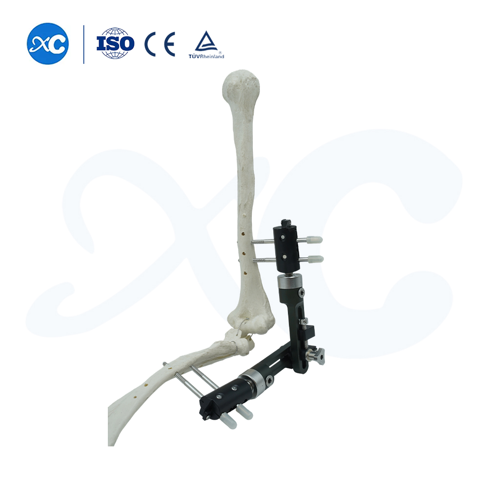Upper Limb External Fixators - Buy Product on XC Medico