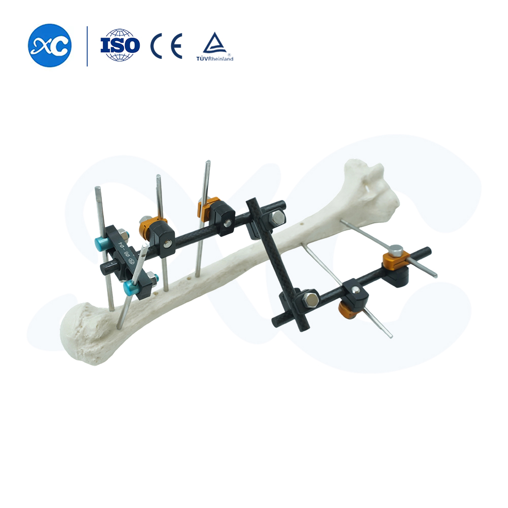 Upper Limb External Fixators - Buy Product on XC Medico