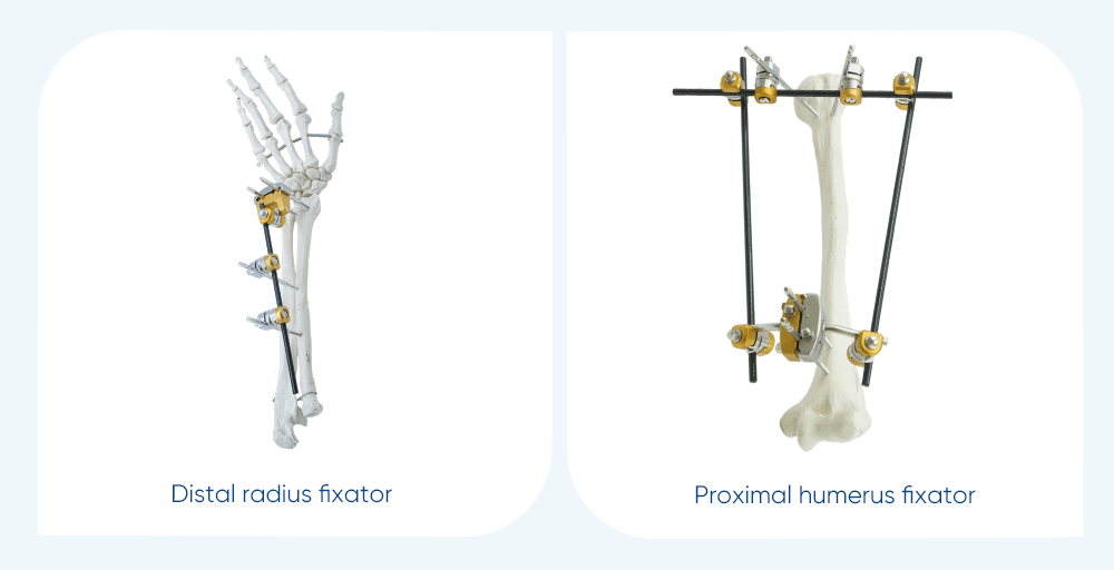 Upper Limb External Fixators - Buy Product on XC Medico
