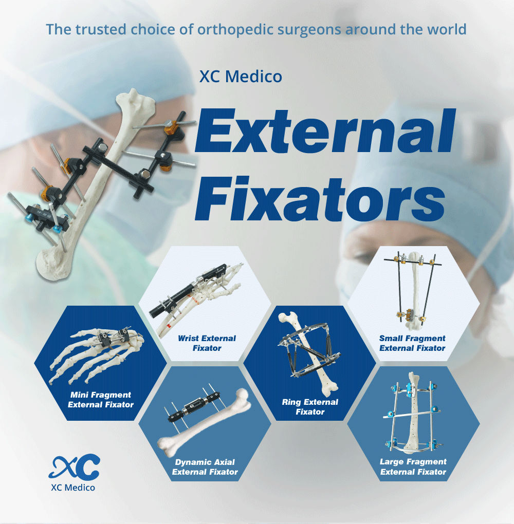 Upper Limb External Fixators - Buy Product on XC Medico