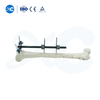  External Fixator for Leg - Buy Product on XC Medico
