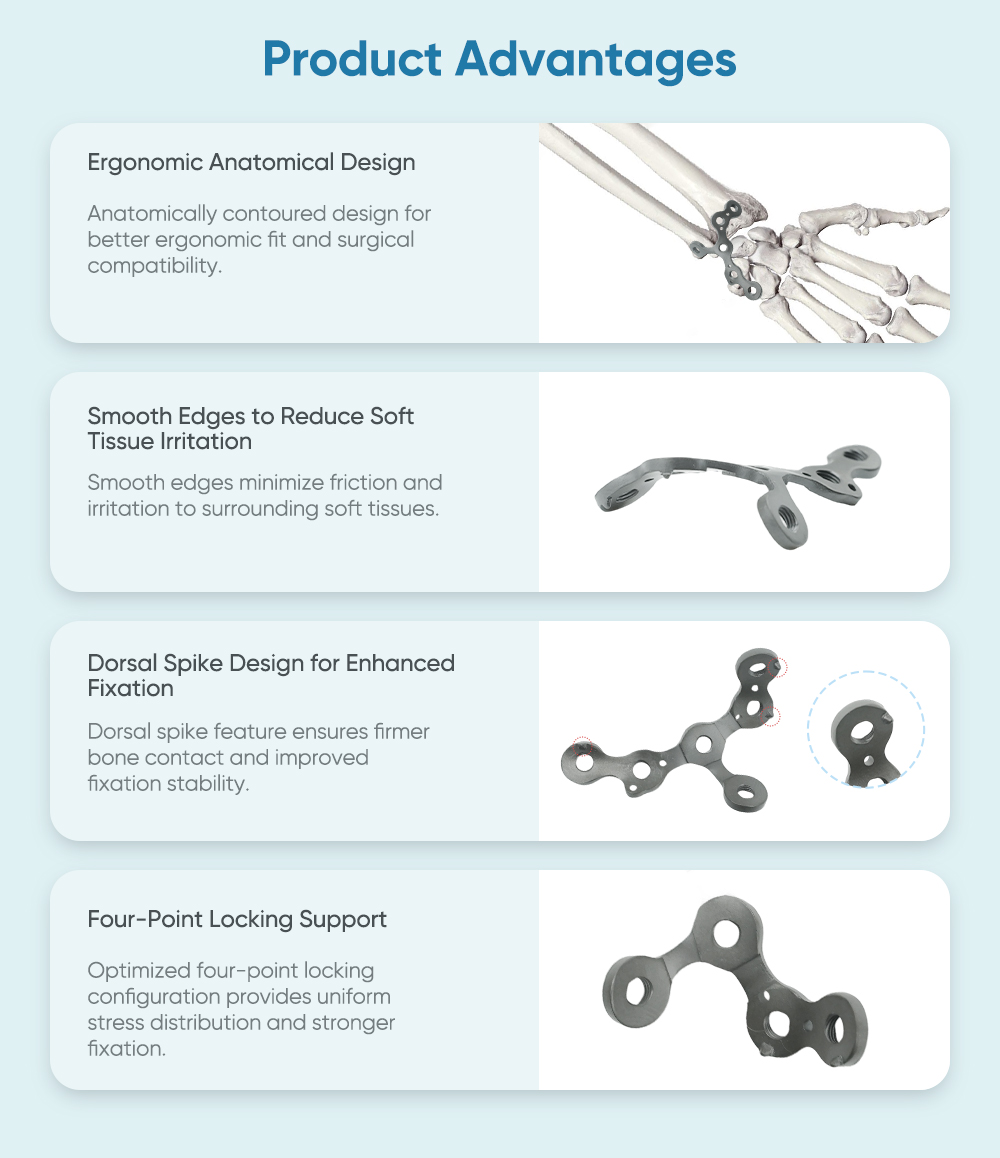 Locking Plate for Ulnar Styloid Process II - Buy Product on XC Medico