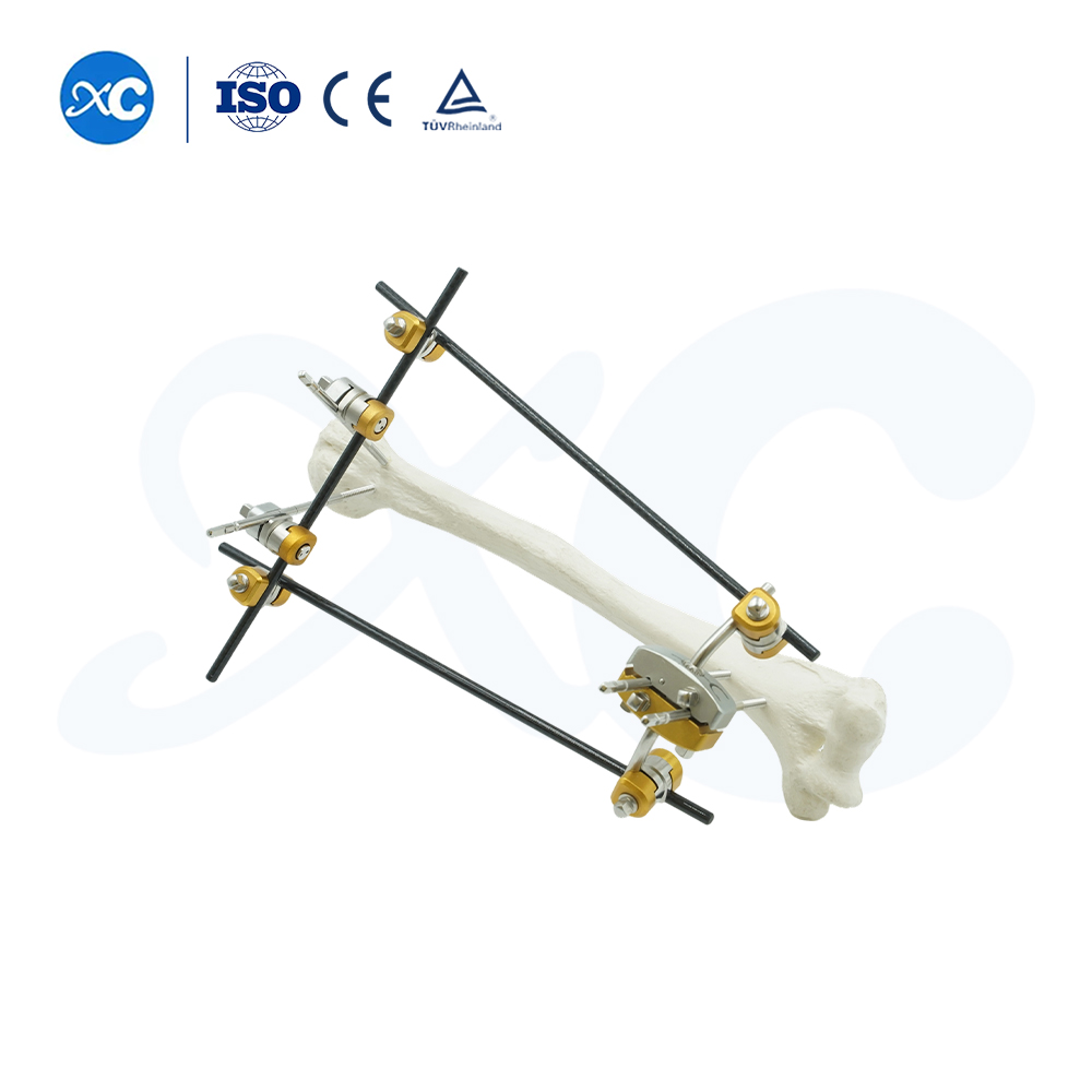Upper Limb External Fixators - Buy Product on XC Medico