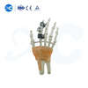 External Fixation for Metacarpals And Phalanges - Buy Product on XC Medico