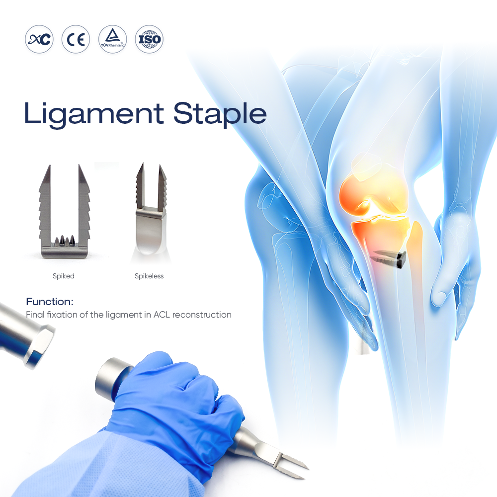 Ligament Staple | Soft Tissue Fixation for ACL Reconstruction | XC Medico Sports Medicine