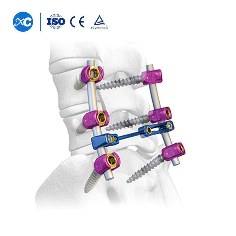 Spine System