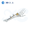 Upper Limb External Fixators - Buy Product on XC Medico