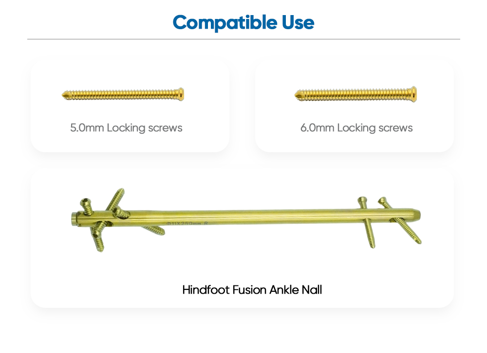 Hindfoot Fusion Ankle Nail Instrument Set - Buy Product on XC Medico