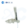 Distal Tibiofibular Locking Plate-III - Buy Product on XC Medico