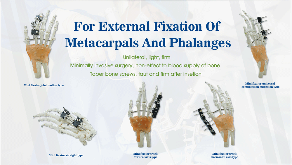 External Fixation Of Metacarpals And Phalanges - Image 2