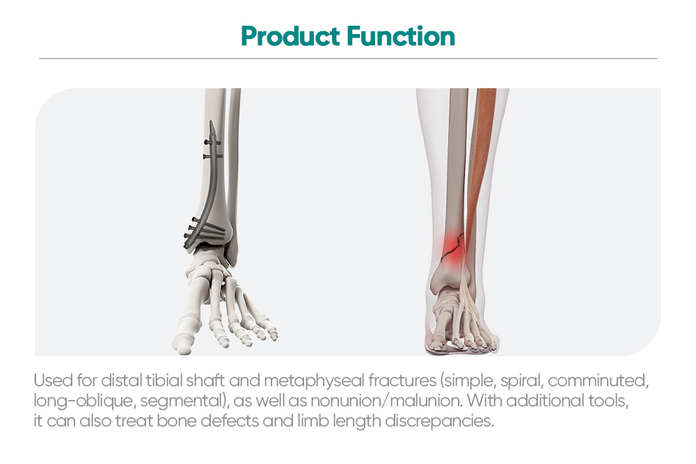 Retrograde Tibial Nail Instrument Set | Distal Tibia Fracture Fixation Kit | XC Medico