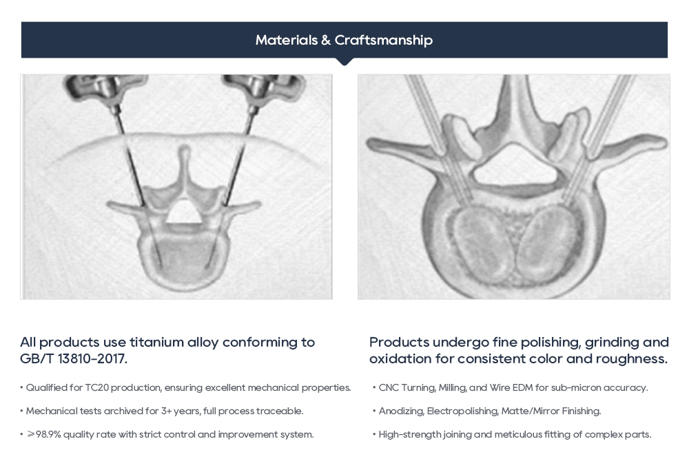 Detailed Components and Surgical Operating Steps of the Flexible Vertebroplasty and Kyphoplasty System