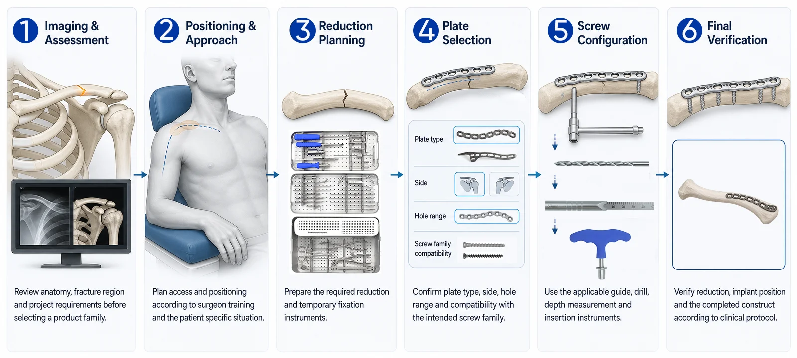 Six-stage clavicle fixation workflow