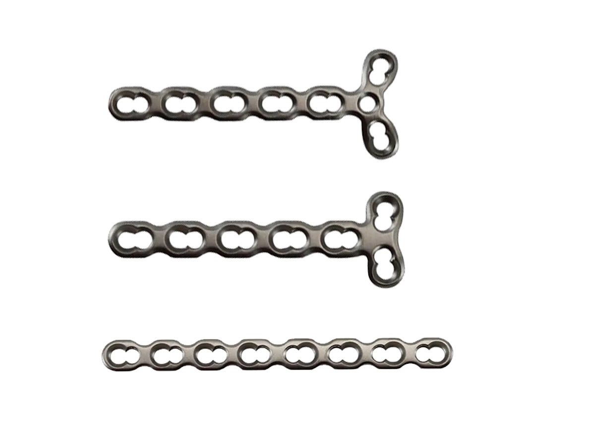2.0 mm titanium mini locking plate configurations