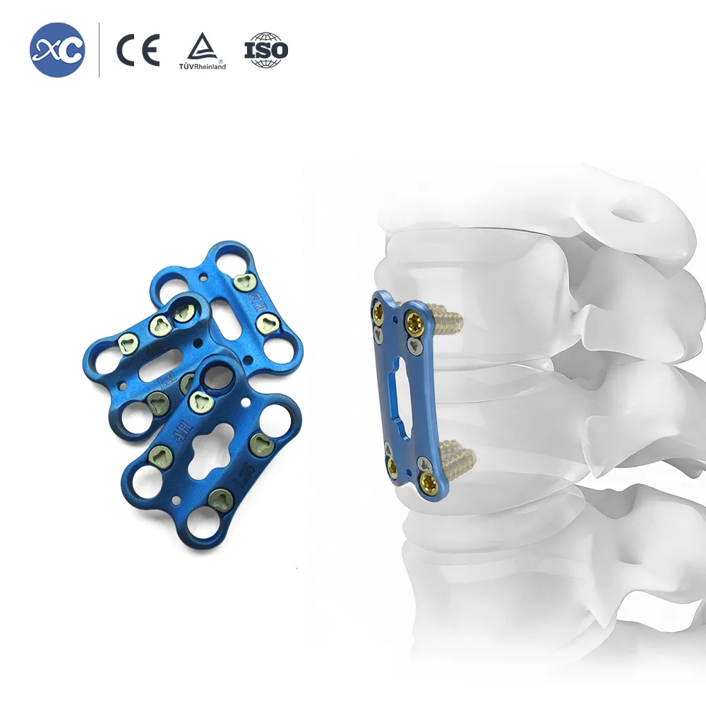 0.8mm Ultra-Thin Anterior Cervical Plate | Cervical Fixation System - 4