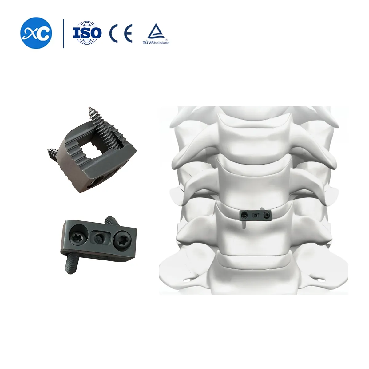 Cervical Titanium Cage-IV with Integrated Fixation | XC Medico-3