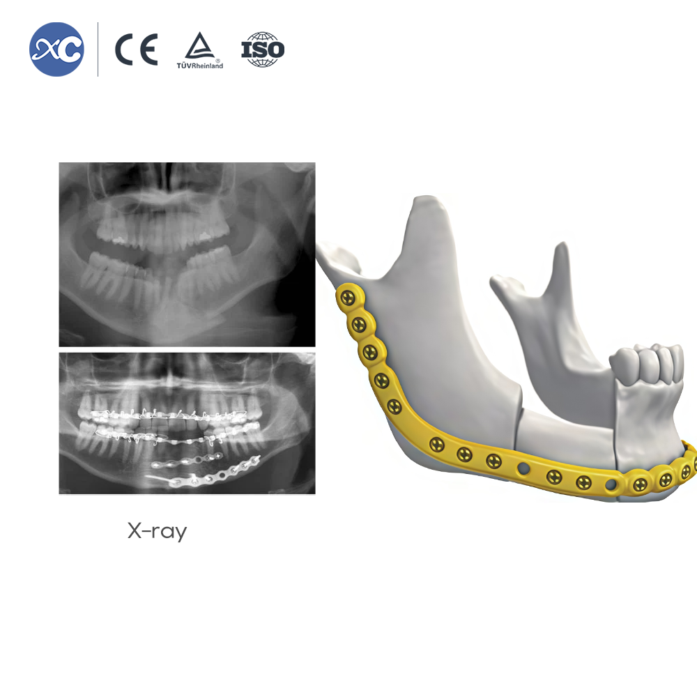 Maxillofaciale instrumentenset van 2,4 mm