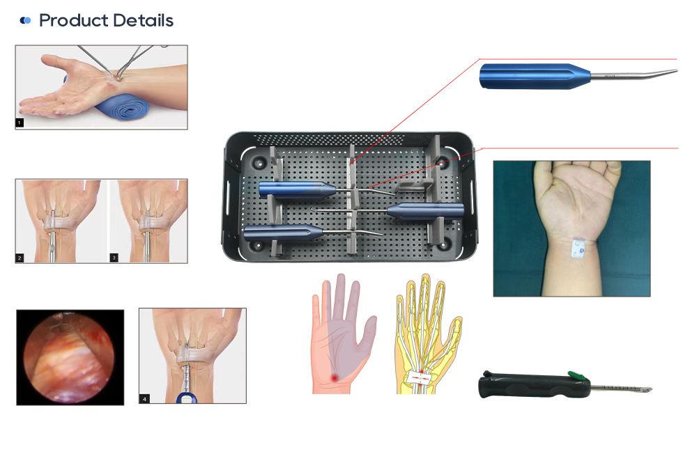 Disposable Wrist Arthroscopy Instrumentation Details: Probe, Punch, Grasping Forceps