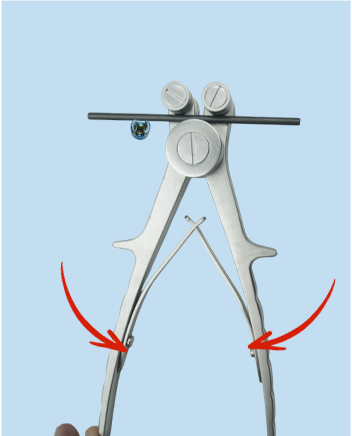Rod bending illustration