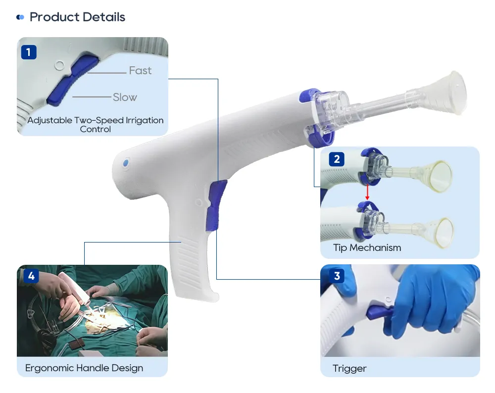 Medical pulsed lavage two-speed control trigger tip mechanism and ergonomic handle