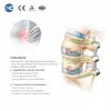 MIS Spinal Portal Instrument Set | Spine Surgery Instruments - 2