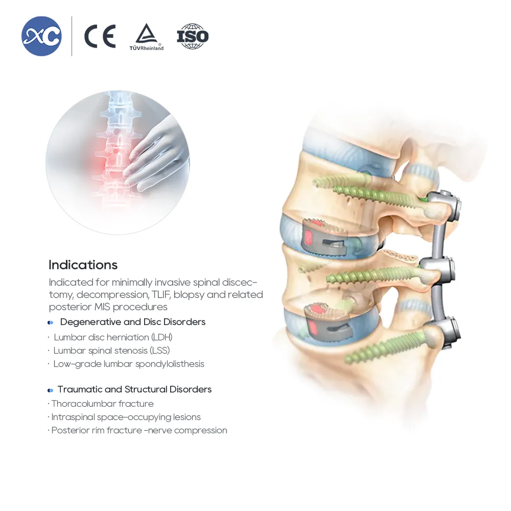 MIS Spinal Portal Instrument Set | Spine Surgery Instruments - 2