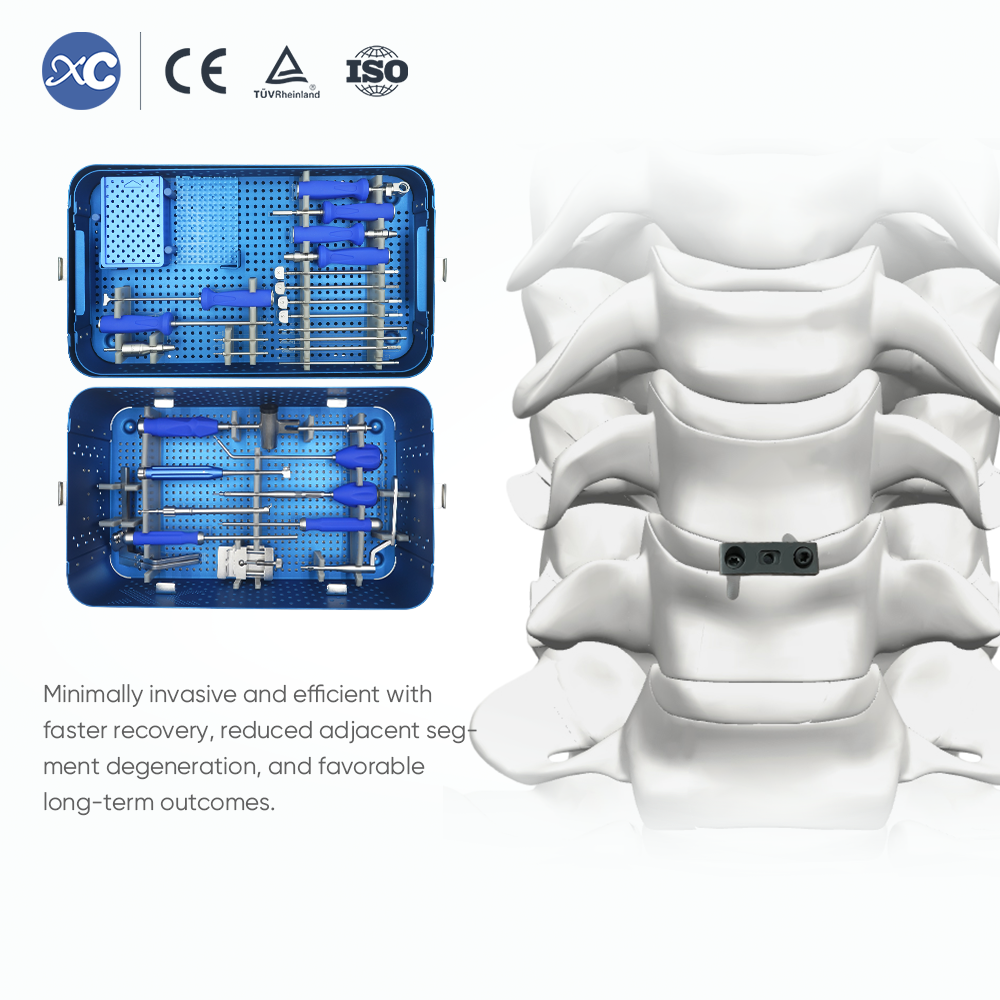 Zero profile cervical cage with 2 locking screws for ACDF
