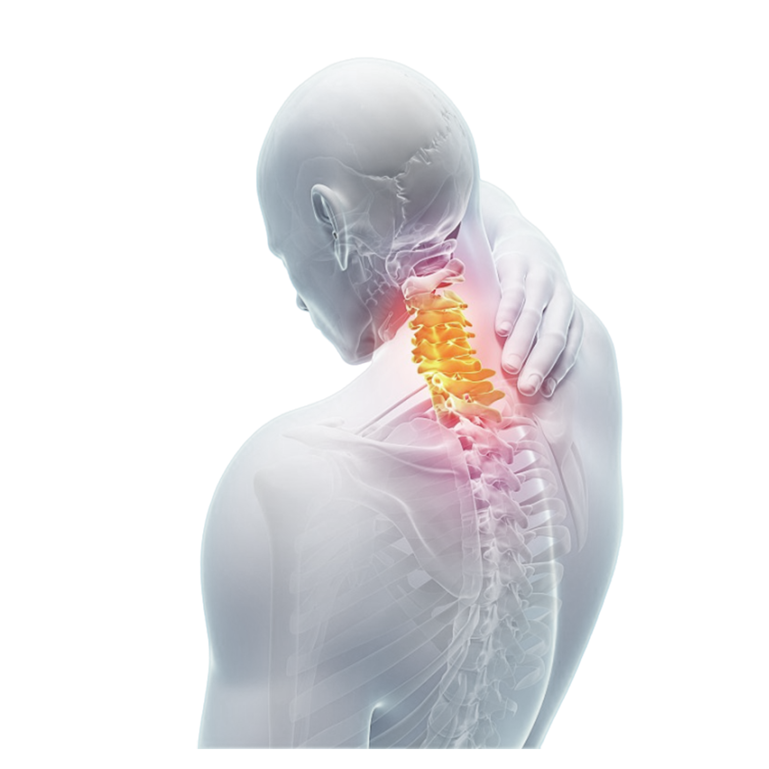 Posterior cervical surgery for fracture tumor and deformity correction