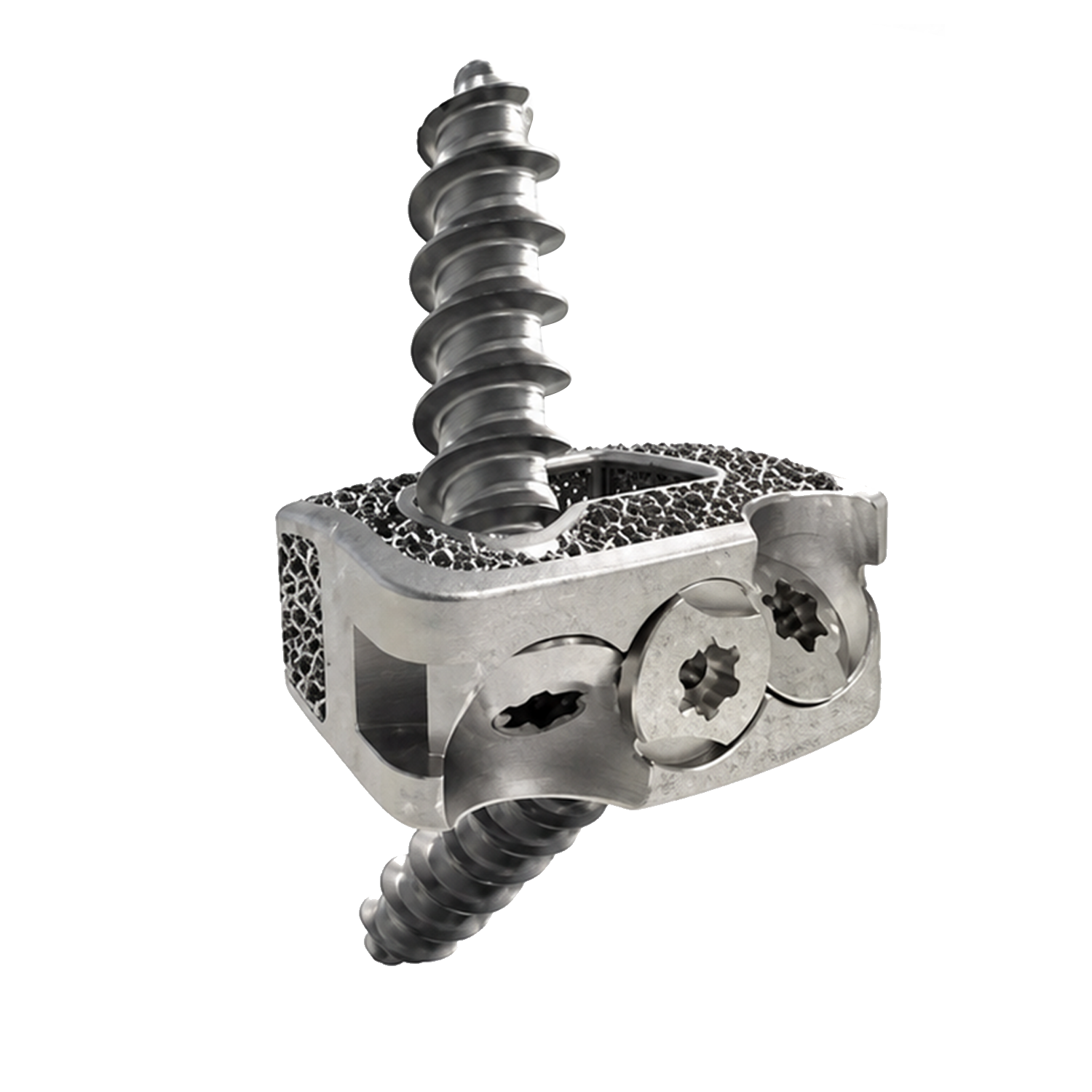 3D-printed sandwich cervical interbody fusion cage
