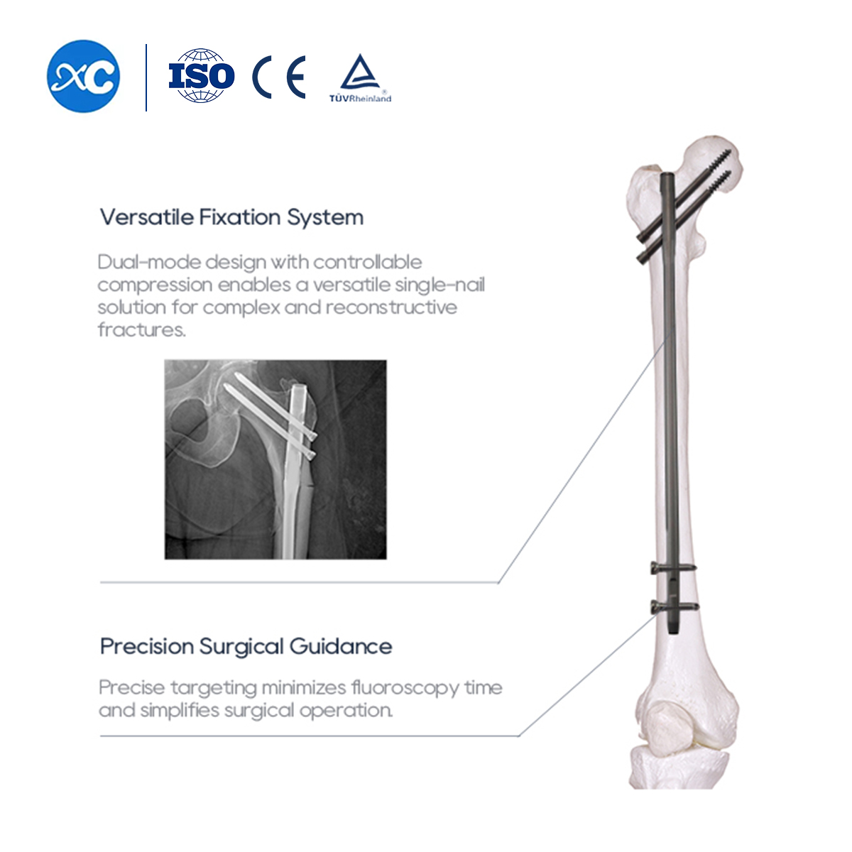 New Femoral Reconstruction Nail Instrument Set | Trauma Fixation