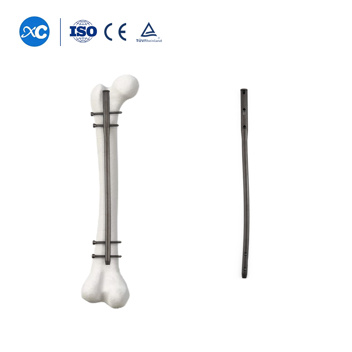 Femoral Intramedullary Nail | Femur Fixation | XC Medico