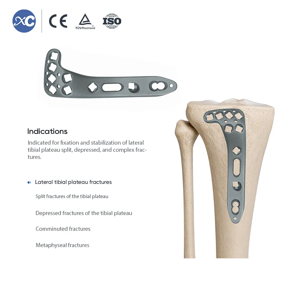 Multi-axial Lateral Tibial Plateau Locking Plate