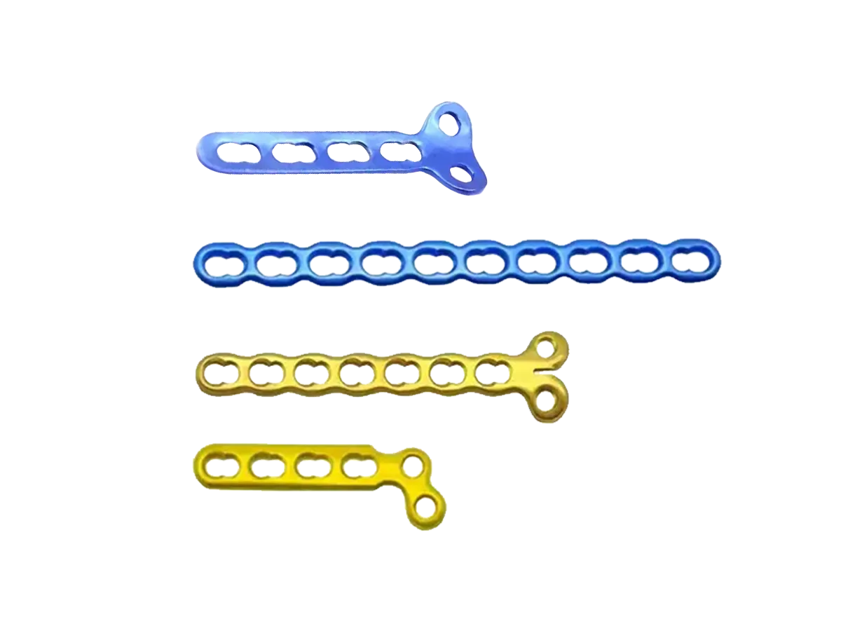 2.7 mm titanium mini locking plate configurations