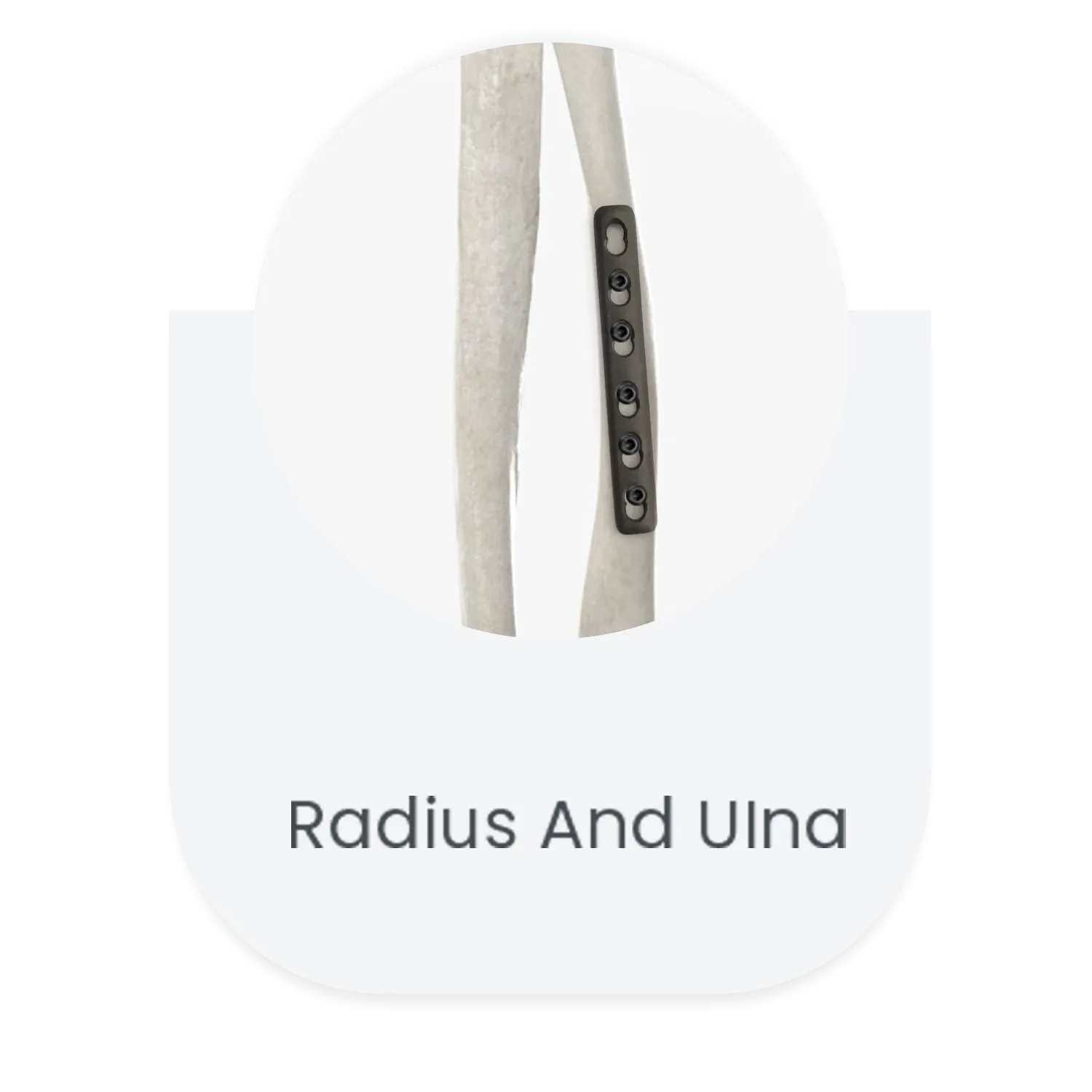 Radius and ulna shaft locking plate
