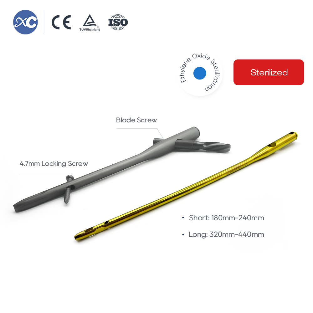 Haste intramedular PFNA | Fixa&ccedil;&atilde;o de Fratura Proximal do F&ecirc;mur