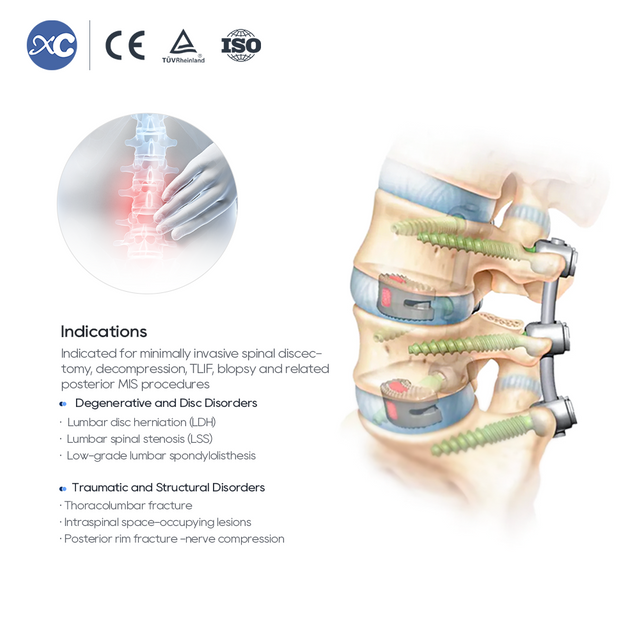 MIS жұлын порталының аспаптар жинағы - XC Medico-да өнімді сатып алыңыз