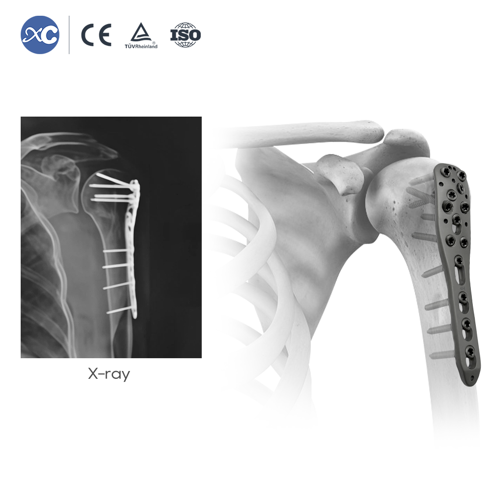 Small Fragment Instrument Set | 2.7/3.5mm Orthopedic Plate Kit | XC Medico