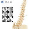 Transforaminal Endoscopic 10.0 Instrument Set | XC Medico